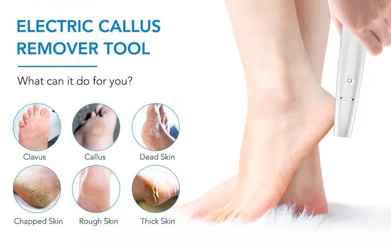 👍🏻Electric Feet Callus Remover 🎁Save 65%,today only